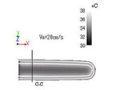 }2 Temperature distribution of blood and solid tissue in the longitudinal direction of the finger model.