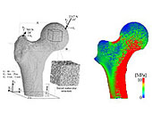 }3 Image-based finite element analysis of human proximal using medical CT image combined with large-scale computation. 