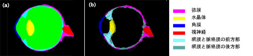 }6 Image and Mesh:(a) Image,(b)Mesh Model