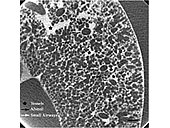 }1 Representative micro-CT image showing many small airways and alveoli at FRC. Arrows indicate airways (white: small airways, black: alveoli) and stars indicate vessels. Bar: 500 mm.